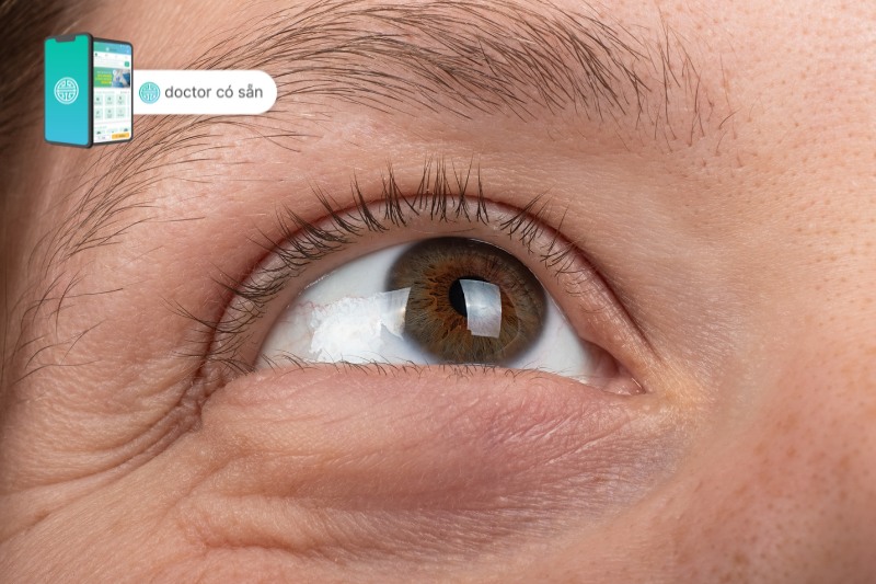 Ghép giác mạc giúp cải thiện thị lực, giảm đau mắt và điều trị nhiễm trùng mắt