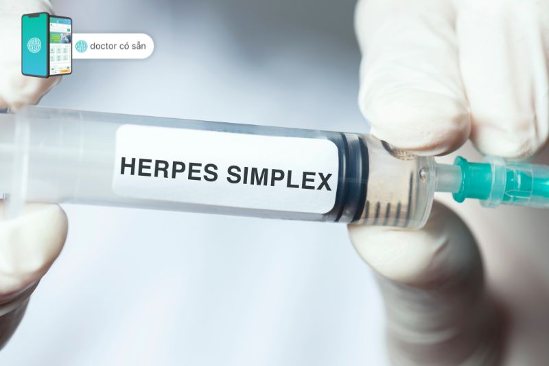 Thuốc Acyclovir cho tác dụng mạnh trên virus herpes simplex