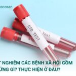 Xét nghiệm các bệnh xã hội từ giai đoạn nghi nhiễm là điều rất cần thiết với mọi đối tượng nhằm tầm soát bệnh