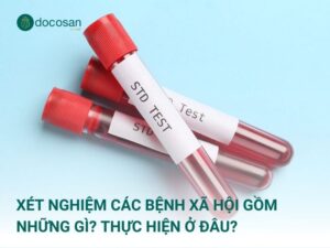 Xét nghiệm các bệnh xã hội từ giai đoạn nghi nhiễm là điều rất cần thiết với mọi đối tượng nhằm tầm soát bệnh