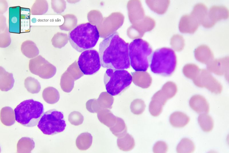 Bệnh bạch cầu tạo nhiều tế bào máu bất thường