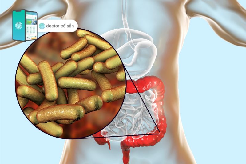Bệnh lỵ trực khuẩn do nhiễm khuẩn Shigella đường ruột