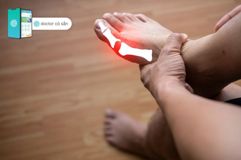 Bệnh gout là một dạng bệnh xương khớp