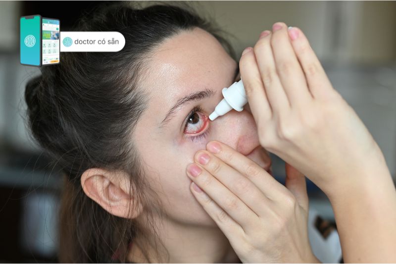 Thuốc nhỏ mắt được bác sĩ kê giúp giảm viêm, sưng và đau mắt đỏ nặng