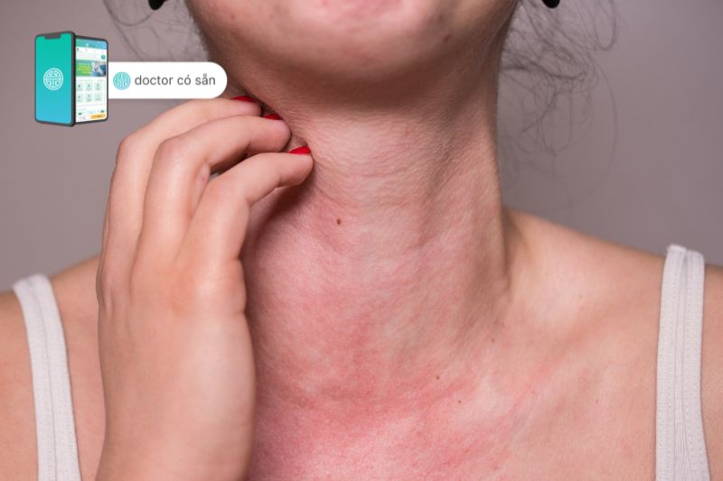 Ngứa da và da ửng đỏ có thể là dấu hiệu của dị ứng mỹ phẩm body