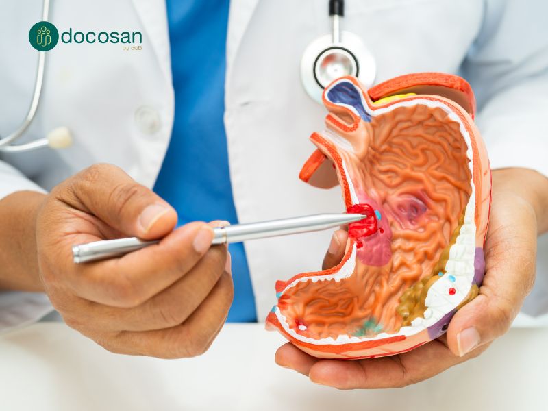 điều trị bệnh viêm loét dạ dày tá tràng