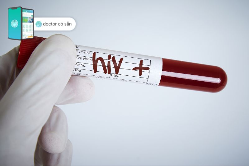 Cần xét nghiệm HIV đối với người từ 15 tuổi trở lên khi khám sức khỏe visa Úc
