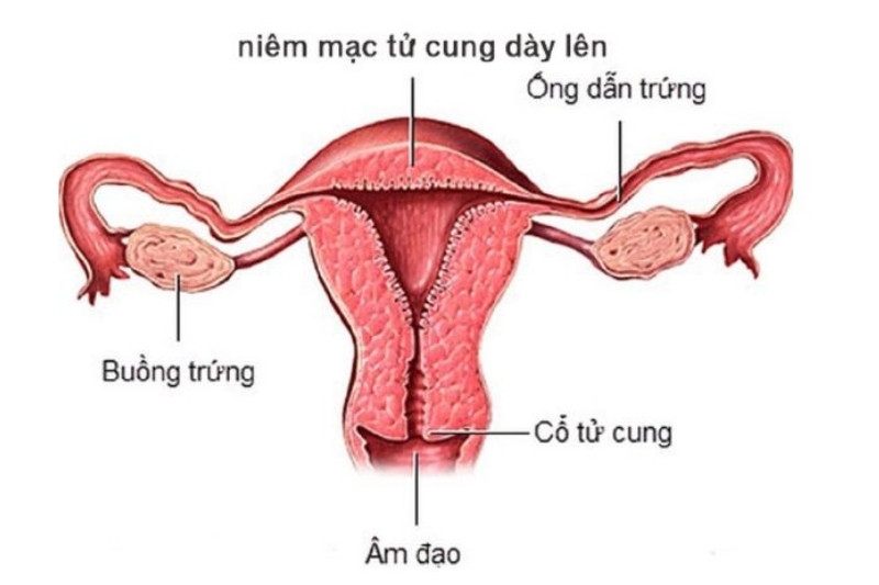 Khi mang thai 1 tuần tuổi, lớp niêm mạc tử cung thường dày lên