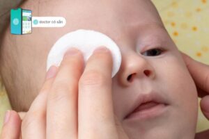 thuốc nhỏ mắt đau mắt đỏ cho trẻ em
