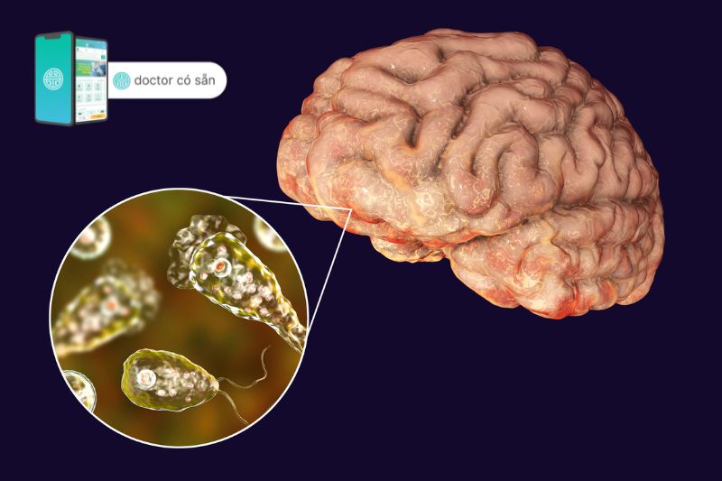 Virus Nipah có thể gây ra các triệu chứng như nhiễm trùng não