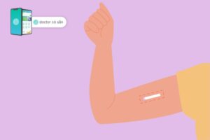 cách tháo que cấy tránh thai