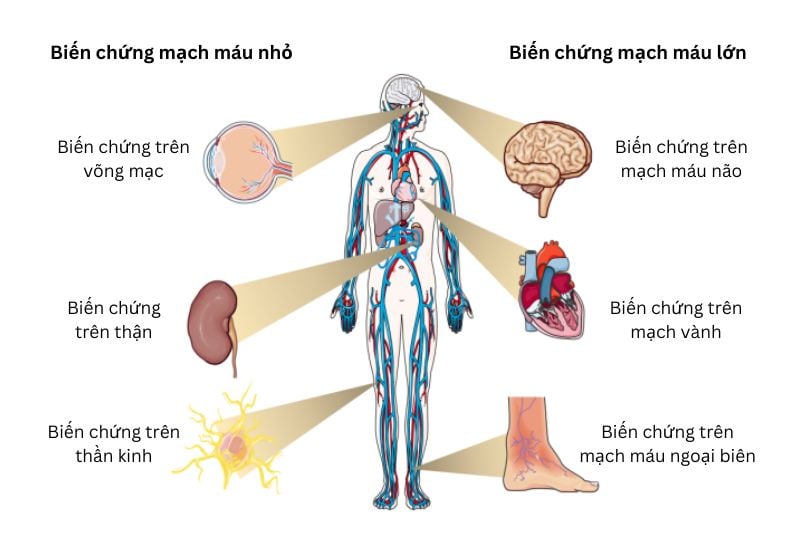 điều trị đái tháo đường