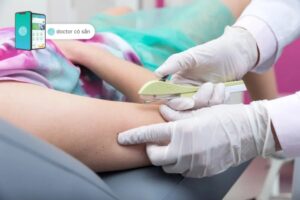 Sau khi cấy que tránh thai cần kiêng gì