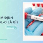 Xét nghiệm định lượng HDL-C là gì? Đối tượng và quy trình thực hiện
