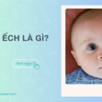 Hở hàm ếch là gì? Nguyên nhân, cách điều trị, phòng ngừa