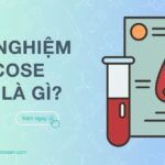 Xét nghiệm glucose máu là gì? Cách đọc chỉ số glucose máu