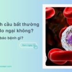 Chỉ số bạch cầu bất thường có đáng lo ngại không? Cảnh báo bệnh gì?