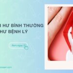 4 cách nhận biết khí hư bình thường và khi hư bệnh lý dễ dàng