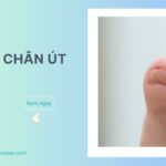 Tê bì ngón chân út là cảm giác tê, mất hoặc giảm cảm giác ngón út.