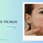 Vitamin E trị mụn: Công dụng, cách sử dụng hiệu quả, an toàn