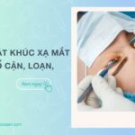 Phẩu thuật khúc xạ mắt là gì? Có nên mổ cận, loạn, viễn thị?