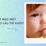 Viêm kết mạc mắt ở trẻ em bao lâu khỏi? Nên dùng thuốc gì?