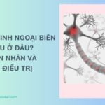Đau thần kinh ngoại biên là đau ở đâu? Nguyên nhân và cách điều trị