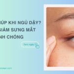 Mắt sưng húp khi ngủ dậy? 10 cách giảm sưng mắt nhanh chóng