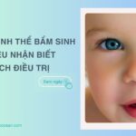 Đục thủy tinh thể bẩm sinh: Dấu hiệu nhận biết và cách điều trị