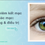 Phân biệt viêm kết mạc với viêm giác mạc: Triệu chứng & điều trị