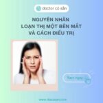 Nguyên nhân loạn thị 1 bên mắt, cách điều trị