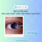 Nên mổ cườm khô với loại thuỷ tinh thể nhân nào tốt nhất?