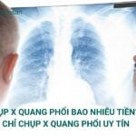 Chụp X Quang phổi bao nhiêu tiền? địa chỉ chụp uy tínChụp X Quang phổi bao nhiêu tiền? địa chỉ chụp uy tín
