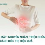 Sỏi Mật: Nguyên Nhân, Triệu Chứng & Cách Điều Trị Hiệu Quả