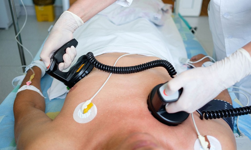 Shock điện chuyển nhịp sử dụng dòng điện có kiểm soát để khôi phục nhịp tim bình thường