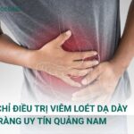 Địa chỉ điều trị viêm loét dạ dày tá tràng uy tín Quảng Nam