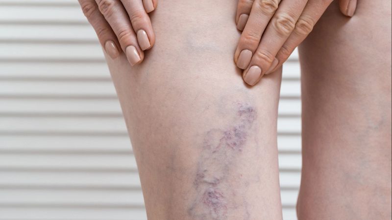 Chi phí khám ban đầu thường không quá cao, dao động vài trăm nghìn đồng