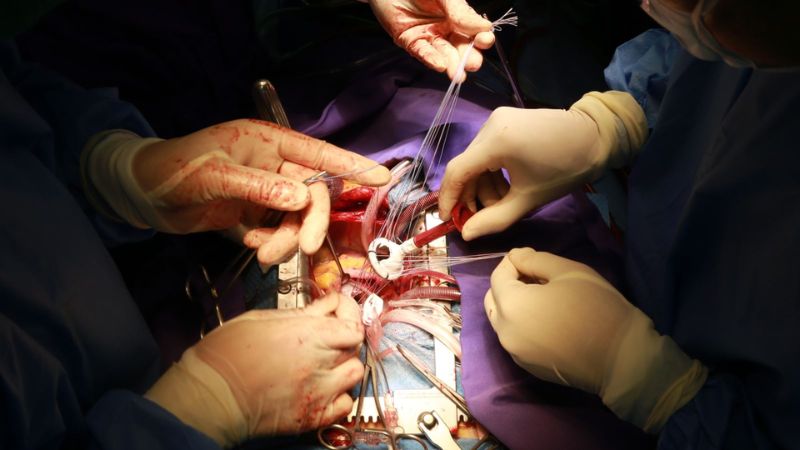 Sửa chữa van tim thường ít gây nguy cơ nhiễm trùng hơn so với thay thế van