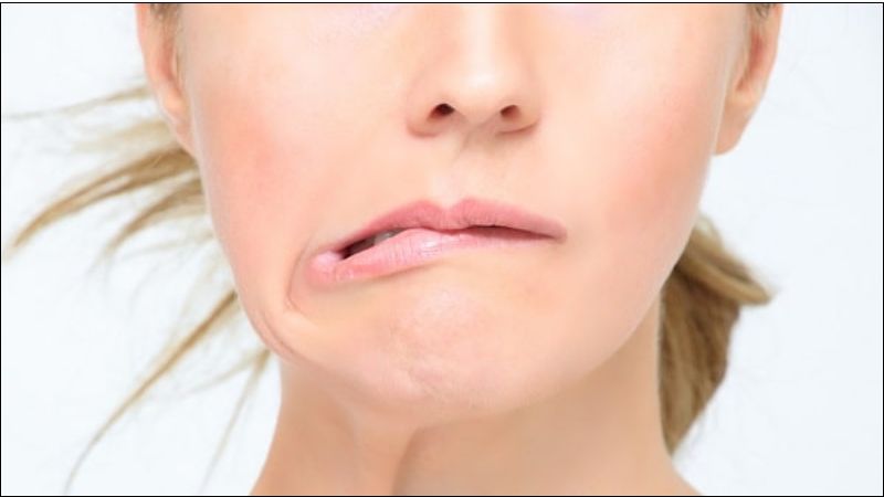 Mặt bị lệch hay méo miệng là một trong các biểu hiện tiêu biểu của bệnh liệt dây thần kinh số 7
