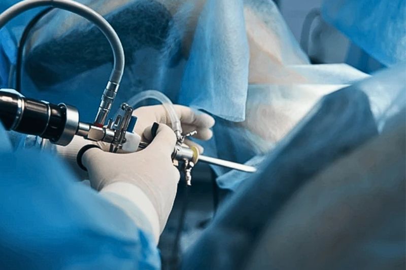 Nội soi bàng quang là thủ thuật dùng ống nội soi có camera để quan sát bên trong bàng quang và niệu đạo