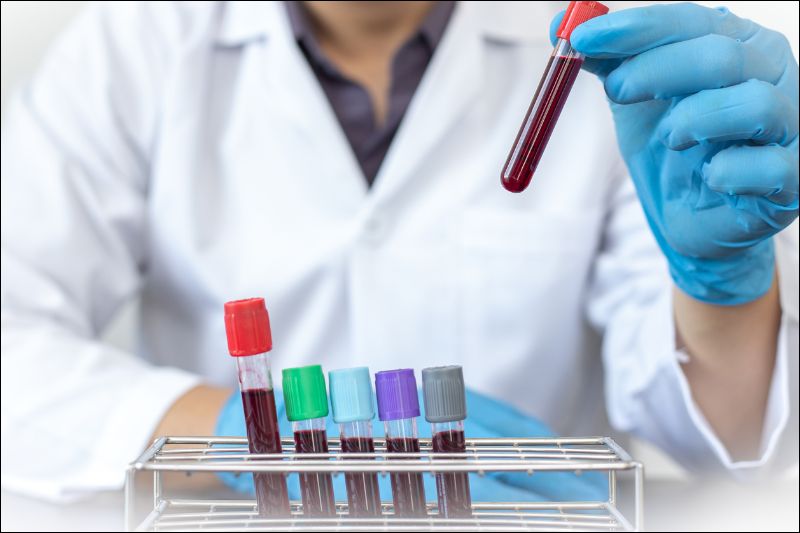 Bệnh nhân có thể cần lấy máu và nước tiểu để xét nghiệm trước khi thực hiện nội soi bàng quang