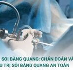 Nội Soi Bàng Quang: Chẩn Đoán và Điều Trị Sỏi Bàng Quang An Toàn