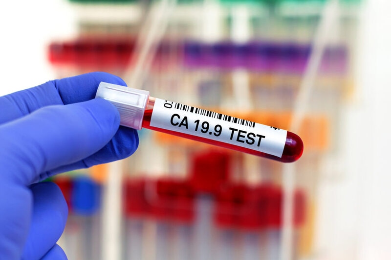 Xét nghiệm máu (CEA, CA 19-9) giúp theo dõi diễn tiến bệnh nhưng không dùng để chẩn đoán chính 