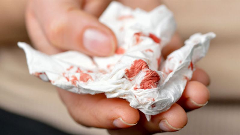 Có thể xảy ra ngay sau mổ hoặc trong vài ngày đầu, thường là lượng ít. Hiếm khi xảy ra chảy máu nhiều