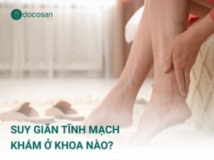 Khi có dấu hiệu suy giãn tĩnh mạch, câu hỏi suy giãn tĩnh mạch khám khoa nào là điều nhiều người quan tâm