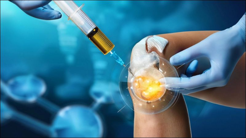 Tiêm huyết tương giàu tiểu cầu (PRP) là một phương pháp điều trị tiên tiến trong lĩnh vực xương khớp