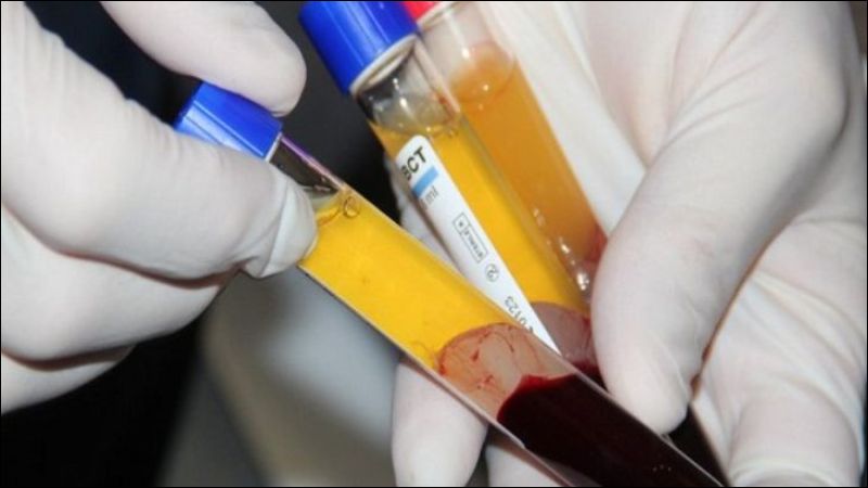 PRP sử dụng tiểu cầu được tách từ máu của chính bệnh nhân nên đảm bảo an toàn và giúp tối ưu hiệu quả điều trị