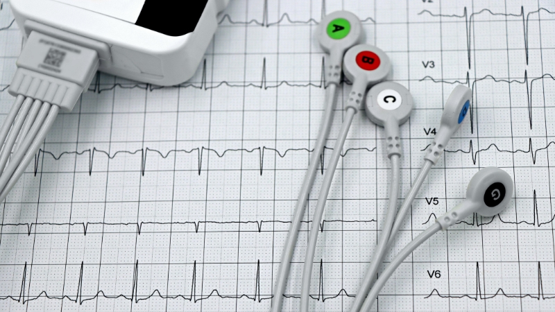 Tim đập nhanh là dấu hiệu ban đầu của bệnh tim mạch nghiêm trọng