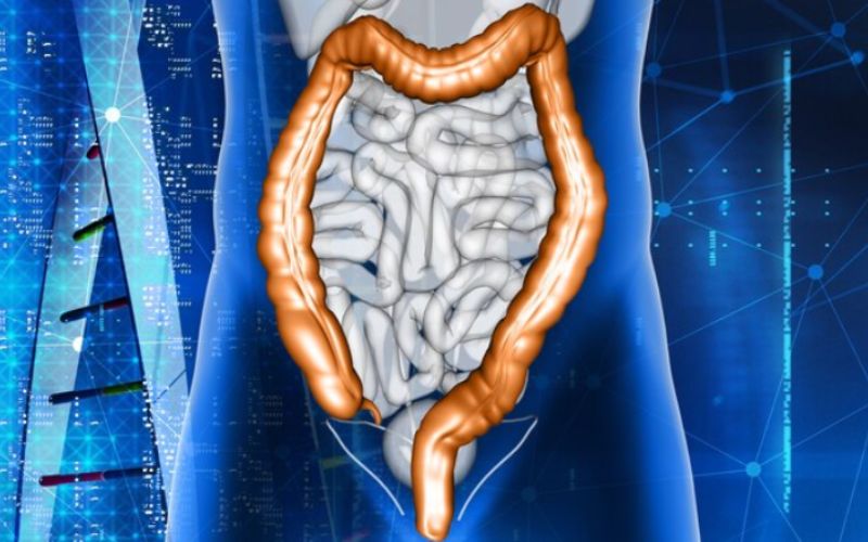 Ung thư đại tràng giai đoạn đầu: Dấu hiệu nhận biết