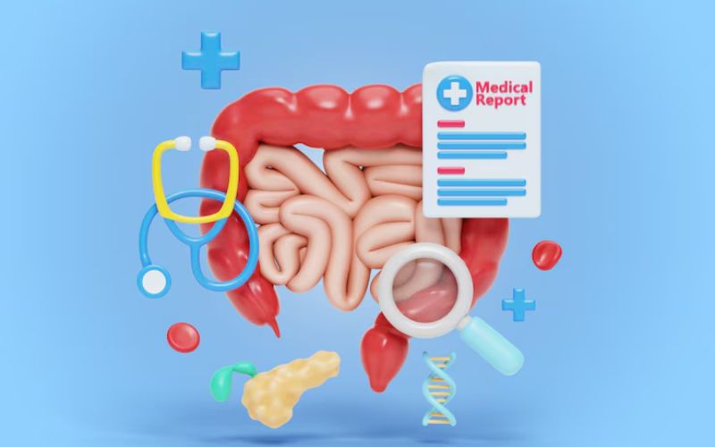 Viêm đại tràng là tình trạng tổn thương đại tràng do viêm, nhiễm,...